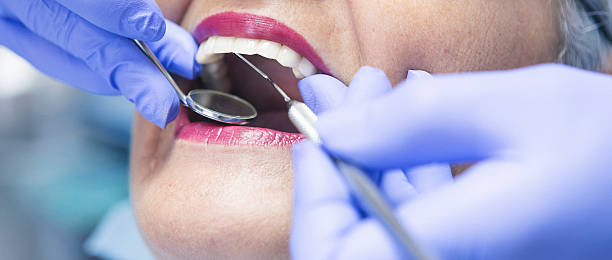 Best Emergency Treatment for Oral Infections in Brush Prairie, WA